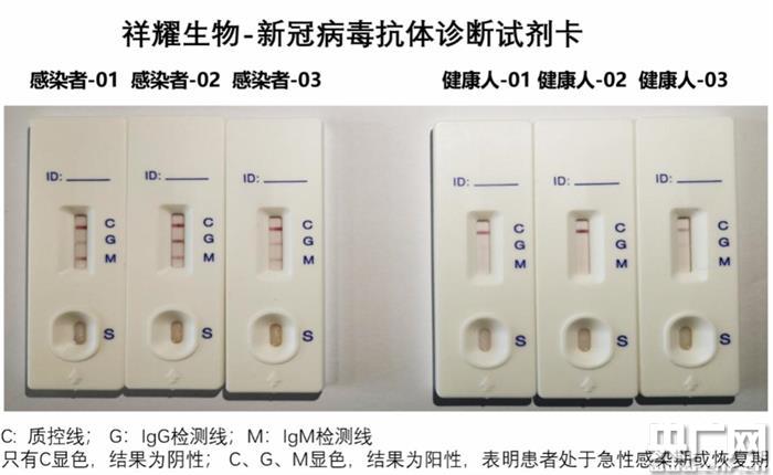 采一滴血十分钟检出华东师大成功研制新冠病毒快检试剂盒